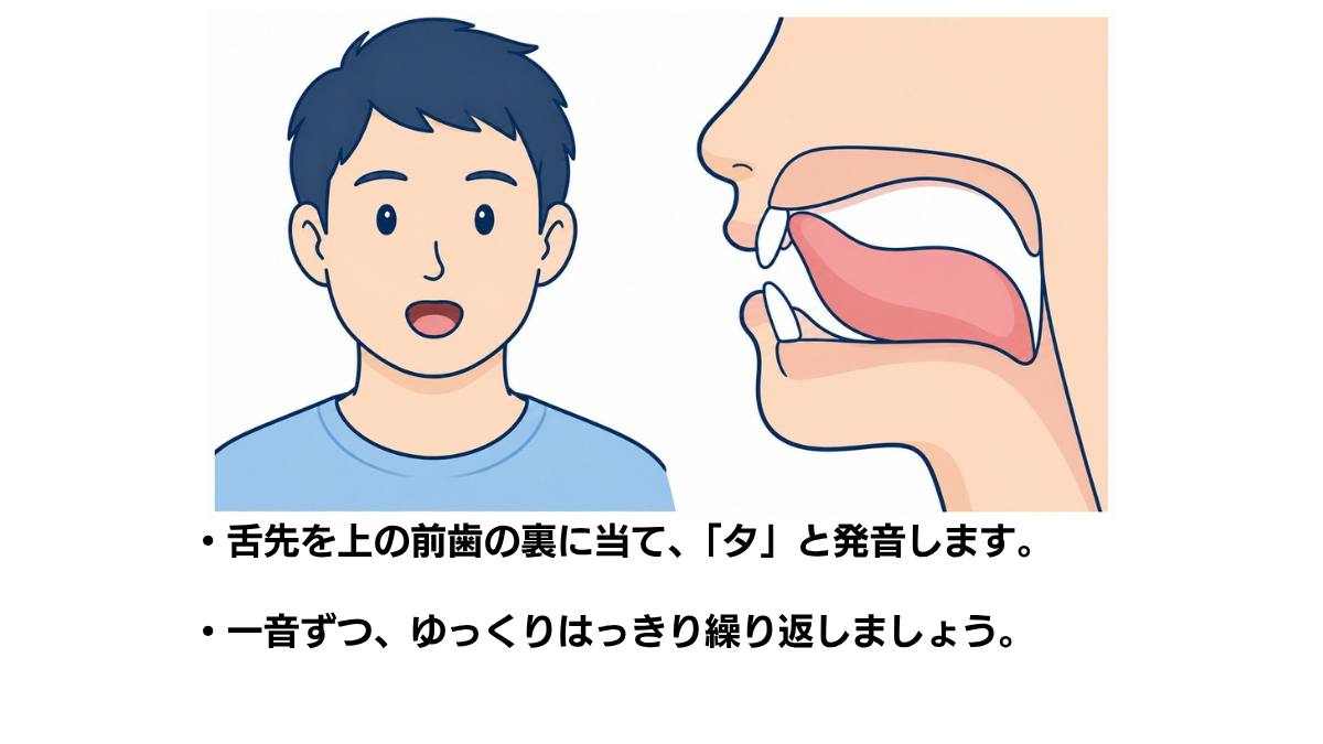 パタカラ体操「タ」のイラスト(説明文つき)|舌先を上の前歯の裏に当て、「タ」と発音する口腔体操の図です